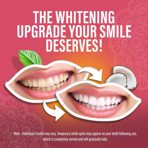 Sensitive Whitening Strips – 16 Day Treatment
